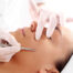 Dermaplaning - LISSÈ Medical Aesthetics - Gig Harbor, WA